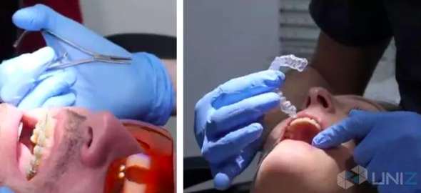 法国正畸学院采用UNIZ科技3D打印机教授现代齿科正畸技术